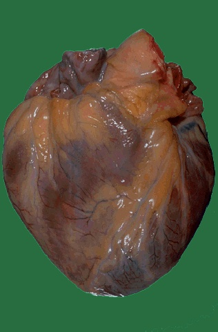A real human heart